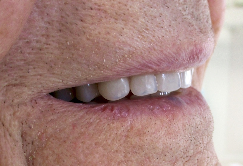 fullsizeoutput_23cd - Perfect 32 Dental Care