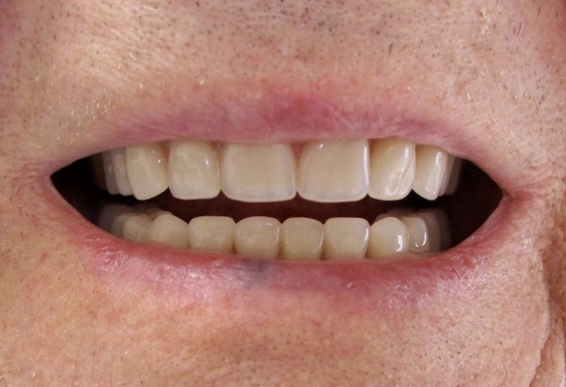 fullsizeoutput_23d1- - Perfect 32 Dental Care